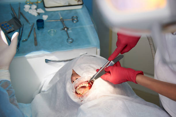 Surgery in the dental clinic. Sinus lifting operation. Surgery in the dental clinic. Sinus lifting operation. surgery for impacted canine teeth stock pictures, royalty-free photos & images