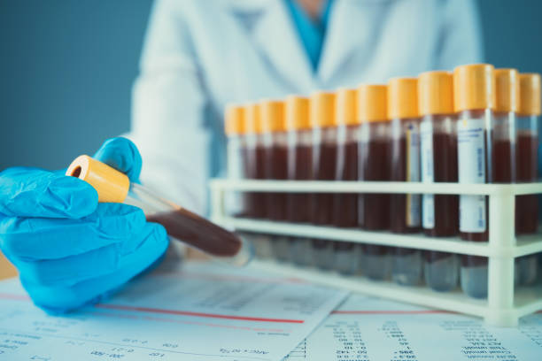 tests sanguins - scientist research test tube lab coat photos et images de collection