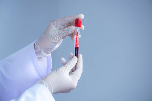 滅菌室の血液検査管を握るラテックス手袋を持つ医者の手 - test tube laboratory biotechnology dna ストックフォトと画像