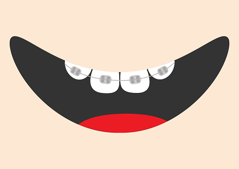 Mouth With Tongue And Tooth Braces Smiling Face Healthy Teeth Brace Body  Part Cute Cartoon Character Oral Dental Hygiene Children Teeth Care Icon  Baby Background Flat Design Stock Illustration - Download Image