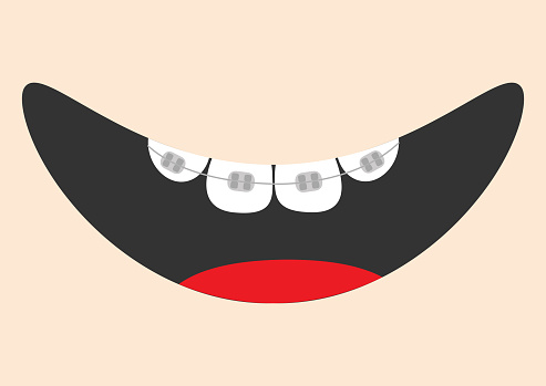 Mouth With Tongue And Tooth Braces Smiling Face Healthy Teeth Brace Body Part Cute Cartoon Character Oral Dental Hygiene Children Teeth Care Icon Baby Background Flat Design Stock Illustration - Download Image Mouth With Tongue And Tooth Braces Smiling Face Healthy Teeth Brace Body Part Cute Cartoon Character Oral Dental Hygiene Children Teeth Care Icon Baby Background Flat Design Stock Illustration - Download Image