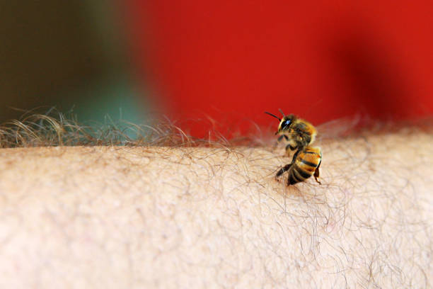 Bee sting A bee stings a man's skin stinging photos stock pictures, royalty-free photos & images
