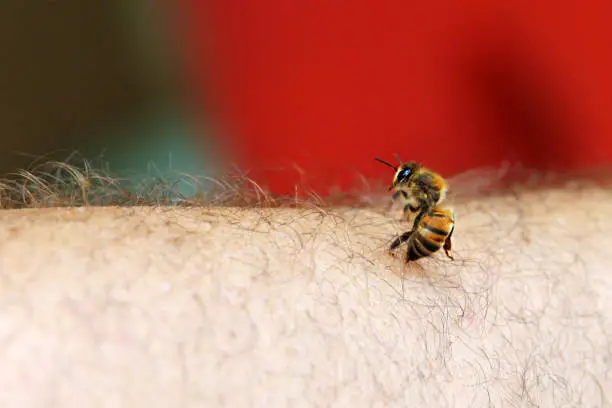 A bee stings a man's skin