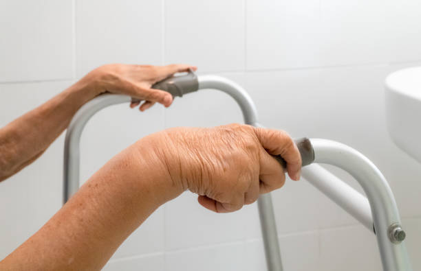 istock Elderly swollen arm or edema arm 1160889827