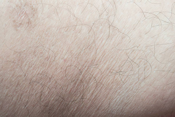 istock scar close-up incision on the leg 1161011257