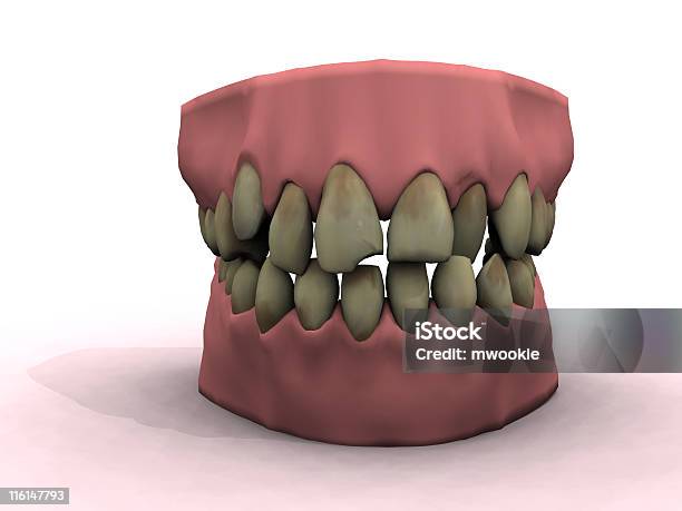 Foto de Bad Dentes e mais fotos de stock de Apodrecer - Apodrecer, Bactéria, Boca Humana