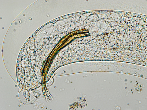 the tail of Aelurostrongylus abstrusus, cat lungworm under the microscope