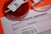 anthrax.jpg?b=1&s=170x170&k=20&c=oHNWo1WASA-M7f8r9IguGDDV25fZi-i8dFuQxx2KGuc=