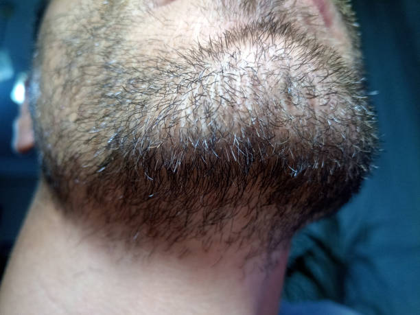 istock Bearded young man, stubble near. Unshaven more than a week. 1161981432