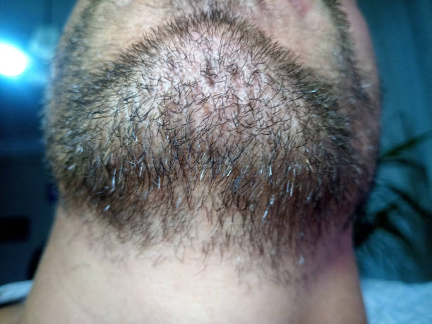 istock Bearded young man, stubble near. Unshaven more than a week. 1161981438