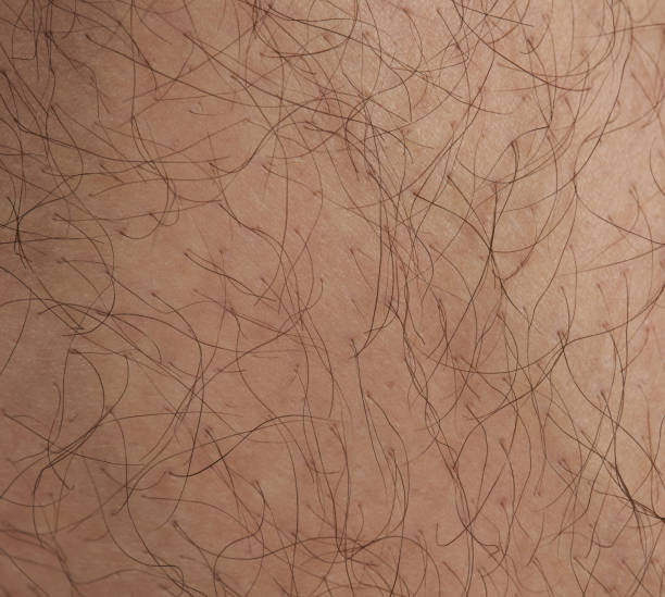 istock Hair on human skin 1161986397