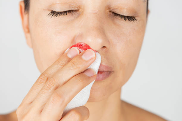 mujer con hemorragia nasal - gauze bandage adhesive bandage healthcare and medicine fotografías e imágenes de stock