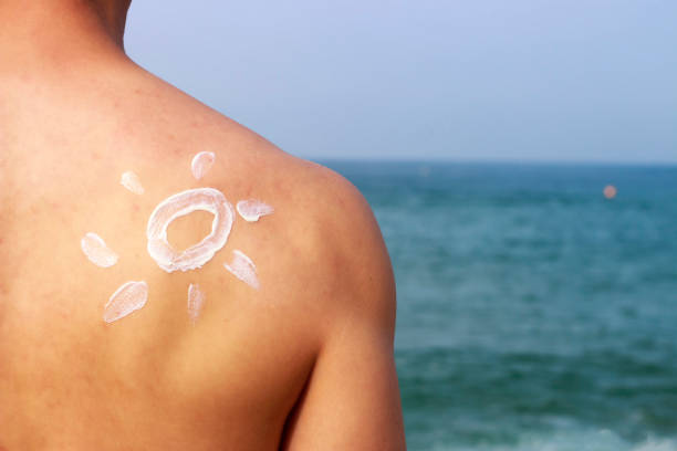 istock Sunscreen on a man's back against the sea, skin protection concept 1162078532