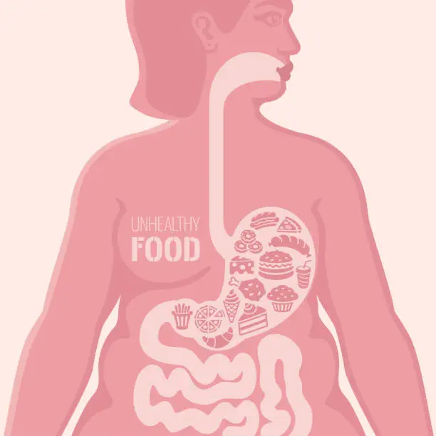 Vector illustration of Woman with unhealthy food