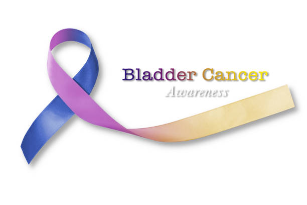 Bladder cancer awareness marigold blue purple  ribbon symbolic bow color on white background (isolated with clipping path) Bladder cancer awareness marigold blue purple  ribbon symbolic bow color on white background (isolated with clipping path) squamous cell carcinoma photos stock pictures, royalty-free photos & images