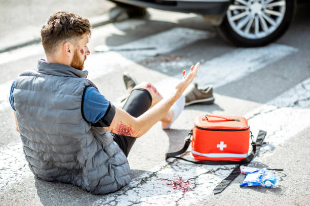 Injured man after the road accident Shocked injured man looking on his wounds, waking up on the pedestrian crossing after the road accident with car pedestrian stock pictures, royalty-free photos & images