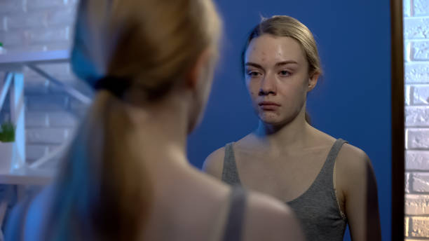 istock Upset teenager crying while examining problem face skin in front of mirror, acne 1162337029