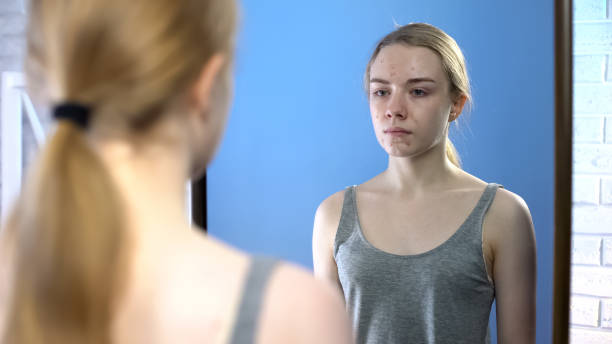 istock Girl with pimples on face looking in mirror feeling insecurities, skin problems 1162337058