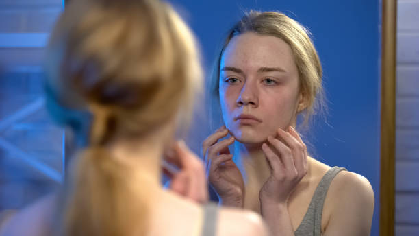 istock Unhappy young lady looking in mirror reflection, skin imperfection, insecurity 1162337224