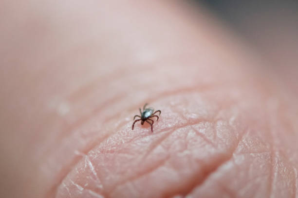istock Tick walking on a human finger close up 1162505215