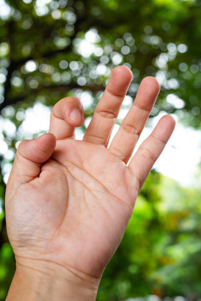 istock Trigger Finger lock on thumb and index finger of woman's front left hand, Suffering from pain, in bokeh green garden background, Close up & Macro shot, Office syndrome, Health care concept 1162536057