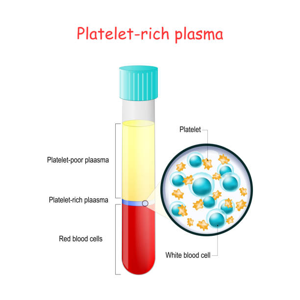 ilustrações de stock, clip art, desenhos animados e ícones de prp. test tube with blood and platelet-rich plasma. components of blood. - laboratory science healthcare and medicine centrifuge