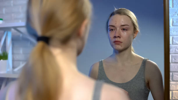 istock Young female looking at puberty face acne in mirror reflection feeling depressed 1162625382