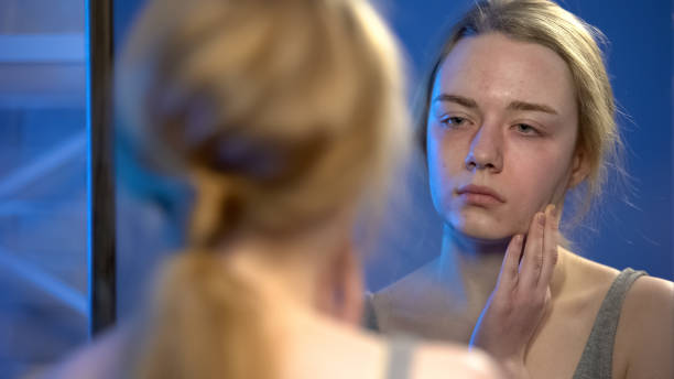 istock Depressed young lady looking in mirror, dissatisfied with appearance, puberty 1162625391