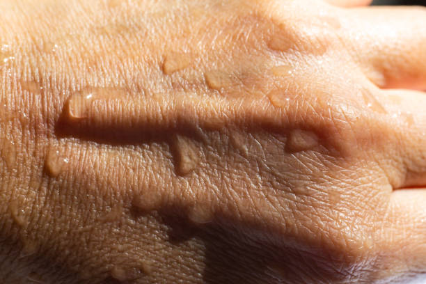 istock Woman's wet back hand with water drops on white acrylic background, Close up & Macro shot, Selective focus, Asian Body skin part,  Relaxing Bath, Healthcare concept 1162665393