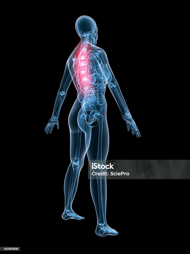 Rückenschmerzen Illustrationen - Lizenzfrei Anatomie Stock-Foto