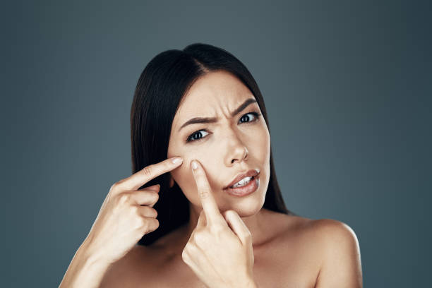 istock Acne. Displeased young Asian woman looking at camera and squeezing pimple while standing against grey background 1162983931