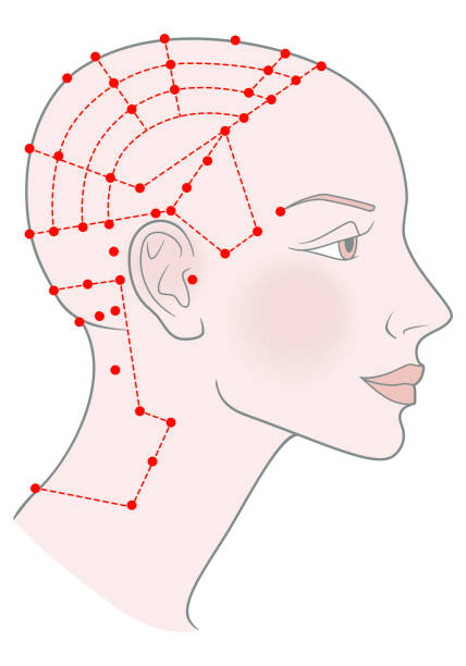 illustrazioni stock, clip art, cartoni animati e icone di tendenza di punti di agopuntura attivi sul modello di profilo ragazza con testa pelata calva rasata e un bel cranio. immagine vettoriale - acupuncture shiatsu reflexology meridians