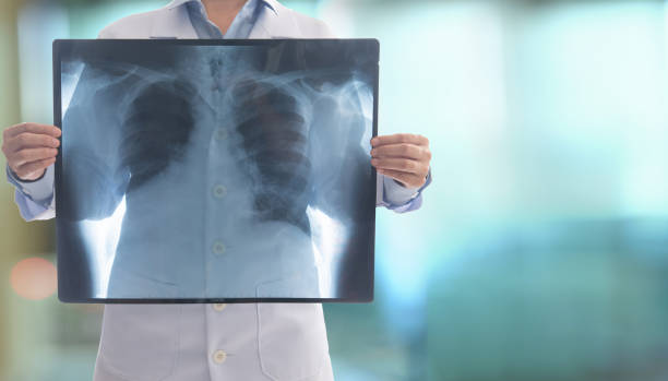 доктор радиология - x ray x ray image chest human lung стоковые фото и изображения