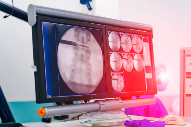 istock Modern equipment in operating room. 1163121261