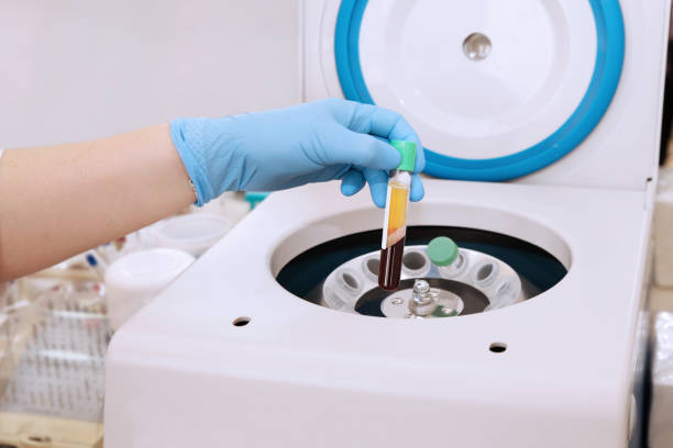 tubo médico com plasma do sangue à disposicão para prp, extraído do centrifugador médico para o levantamento do plasma - plasma - fotografias e filmes do acervo