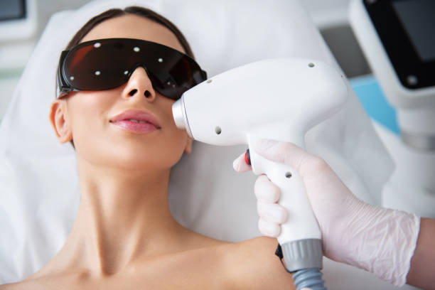 istock Young lady on upper lip laser epilation procedure 1163194738