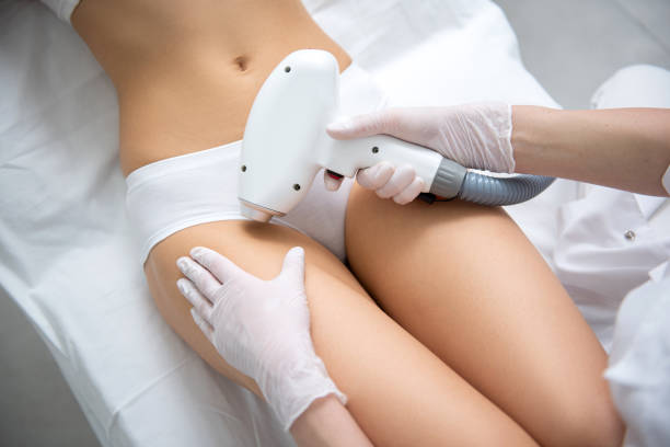 istock Lady on bikini line laser epilation procedure 1163195405