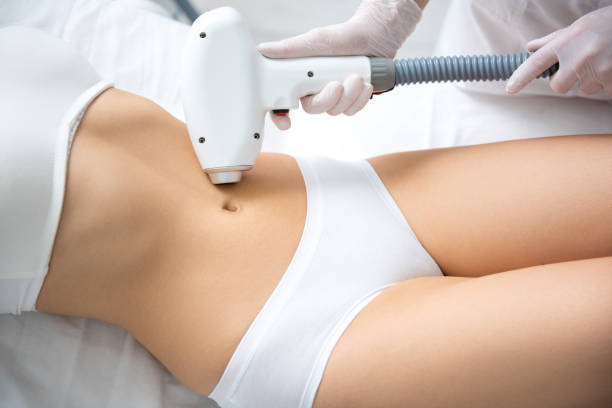 istock Young lady on belly laser epilation procedure 1163195426