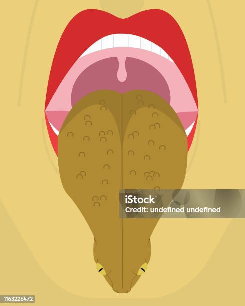 Toad Breating Bad Breath Like A Toad Funny Vector Illustration Stock Illustration ...