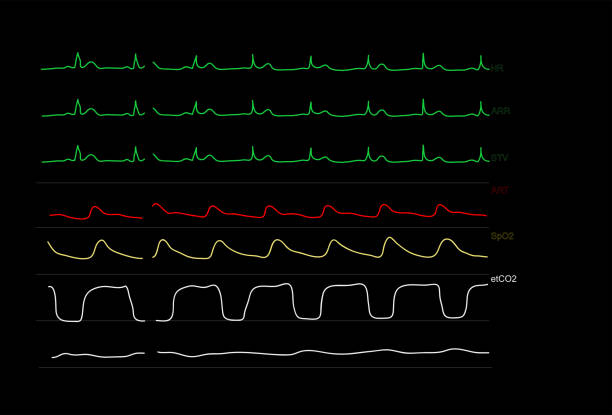 Monitoring display of patient vital signs Monitoring graph displays of patient vital signs of anesthesiology in operating room. Vector illustration monitoring equipment stock illustrations