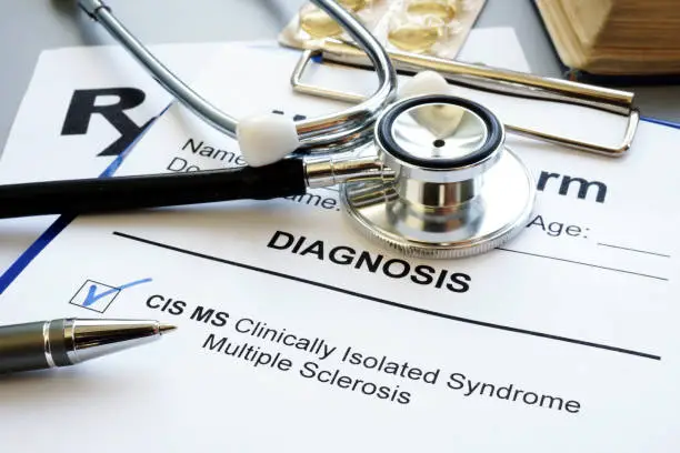 Photo of Clinically isolated syndrome multiple sclerosis cis ms diagnosis.