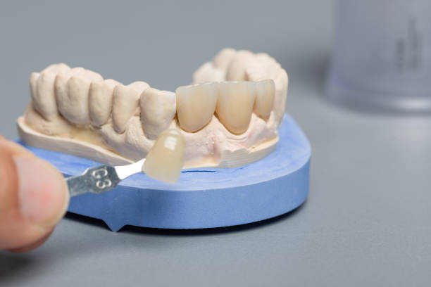 istock cheking veneer of denture parts in denture lab 1163362486