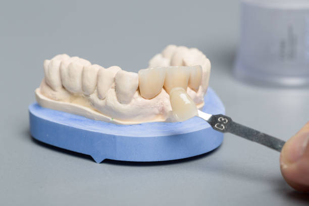 istock Using a shade guide in denture lab to check veneer of new denture parts 1163362515