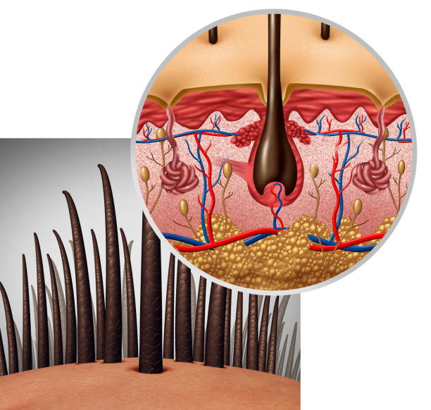 Hair Follicle Anatomy Stock Photo - Download Image Now - Hair Follicle, Hair  Transplant, Hair - iStock