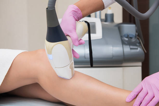 istock Hair removal procedure 1163758175