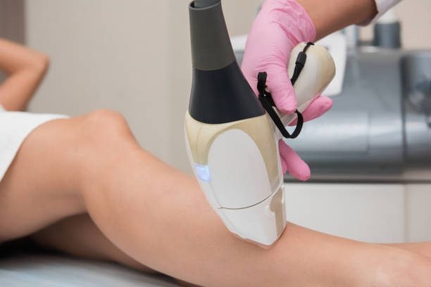 istock Hair removal procedure 1163758184