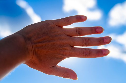 Dorsal aspect of woman arthritis hand against blue sky.