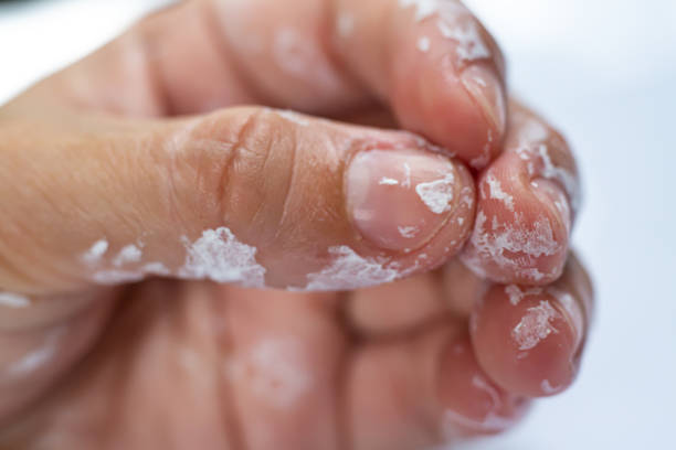 istock Woman's hand be stained with white acrylic glazing putty on white background,Close up & Macro shot, Selective focus, Home concept 1163934656