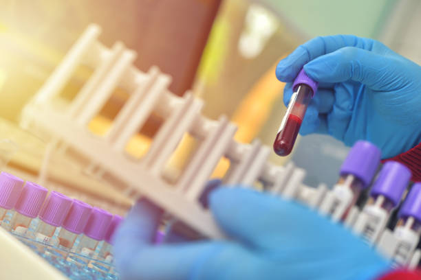 테스트를 위한 혈액 샘플의 튜브. 의료 장비 - laboratory blood laboratory equipment medical sample 뉴스 사진 이미지
