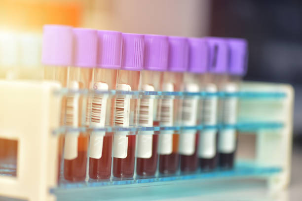 테스트를 위한 혈액 샘플의 튜브. 의료 장비 - laboratory blood laboratory equipment medical sample 뉴스 사진 이미지